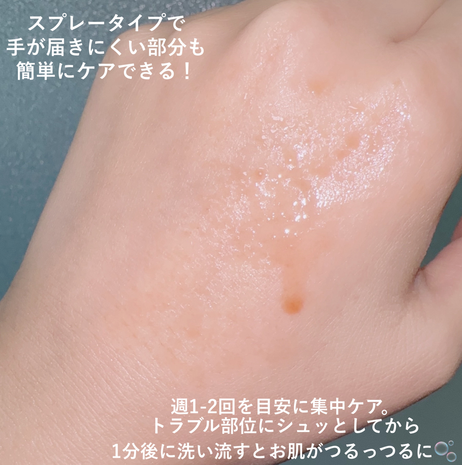 レッドアクネ ボディピーリングショット/MEDICUBE/ピーリングを使ったクチコミ（3枚目）