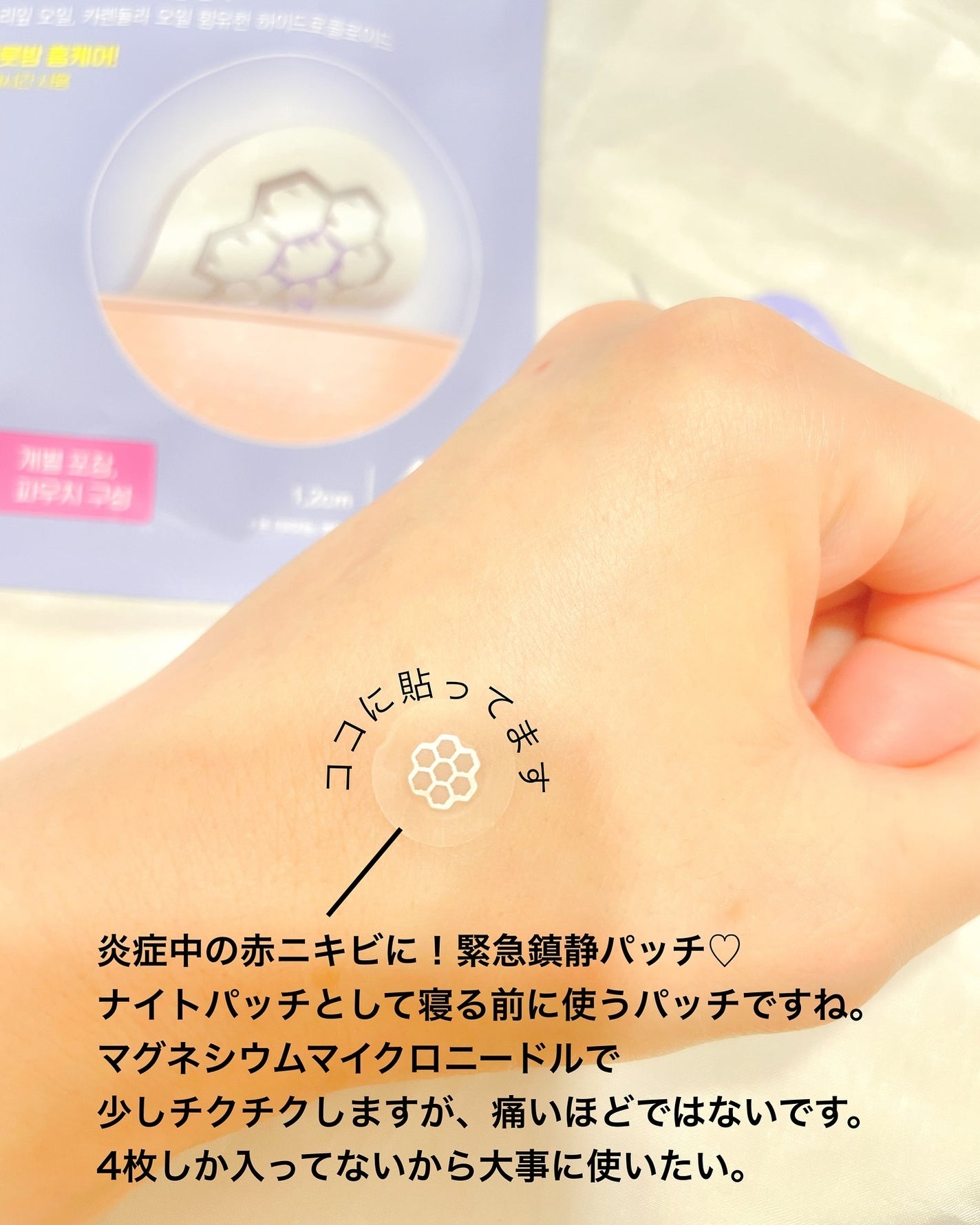 ビューティー スポットパッチ/イージーダムビューティー/にきびパッチを使ったクチコミ(5枚目)