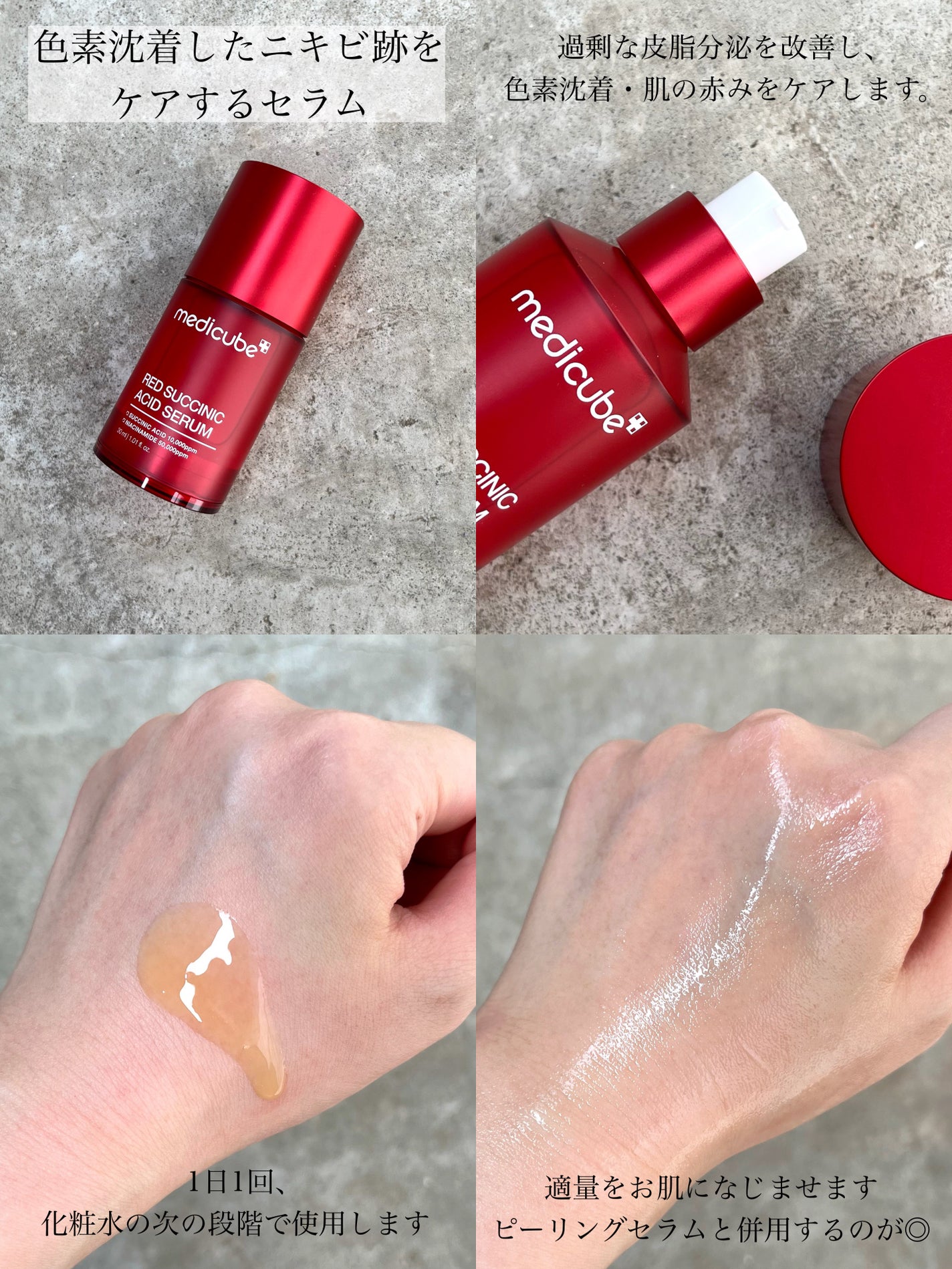 tomomi|コスメレビュー on LIPS 「ニキビ肌を撃退👊🏻ピーリング&鎮静ケアの2ステップで徹底的にケ..」(3枚目)