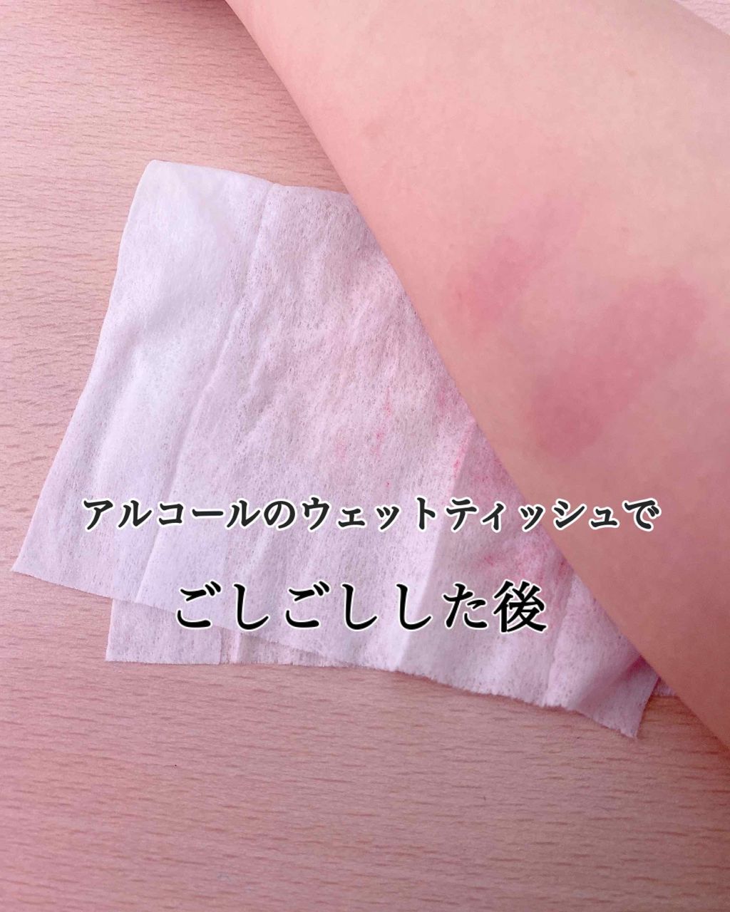 マシュマロティントルージュ/フォーチュン/リップティントを使ったクチコミ(4枚目)