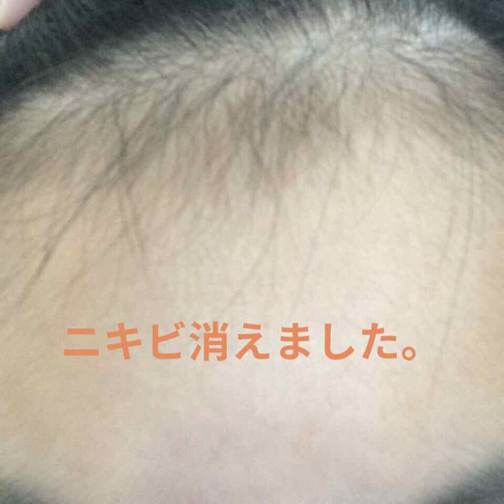 A アクネローション/NOV/化粧水を使ったクチコミ（1枚目）