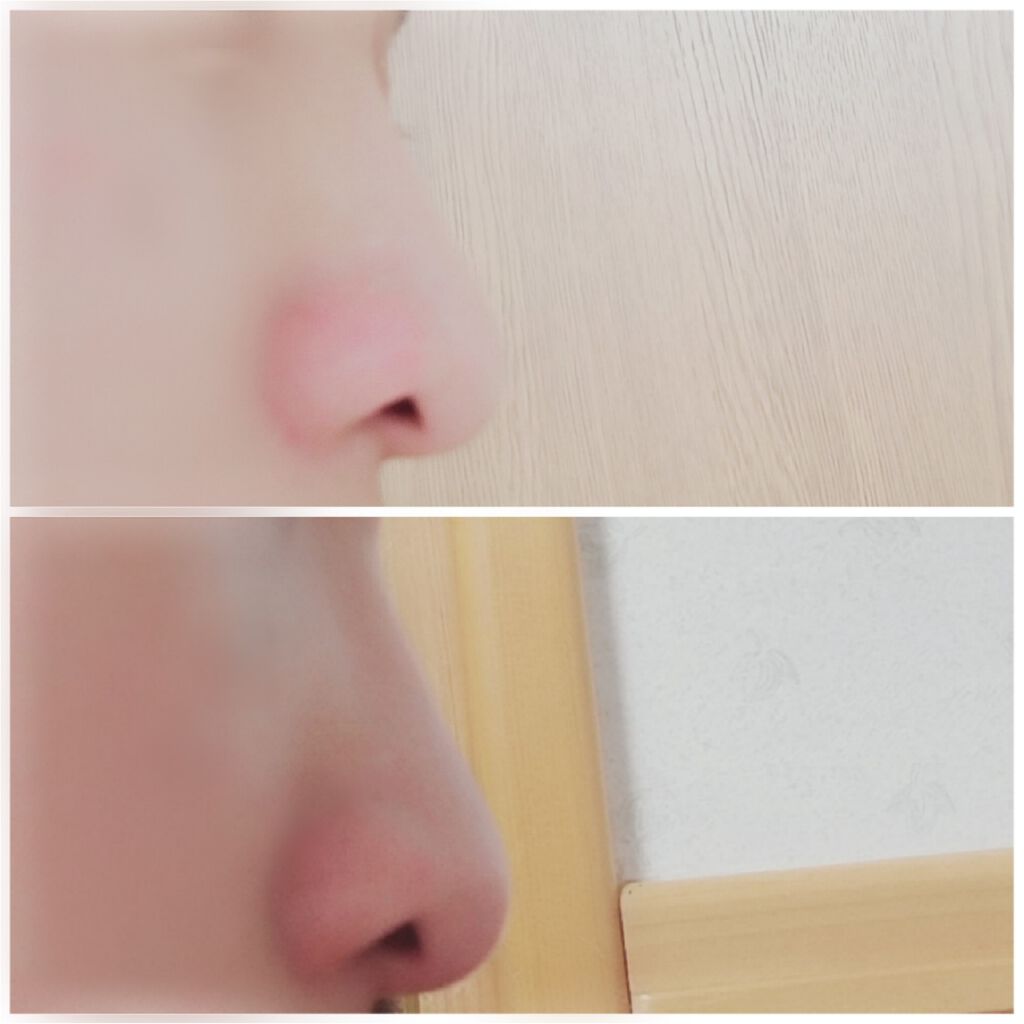 ノーズトレーナー/DAISO/その他スキンケアグッズを使ったクチコミ（3枚目）