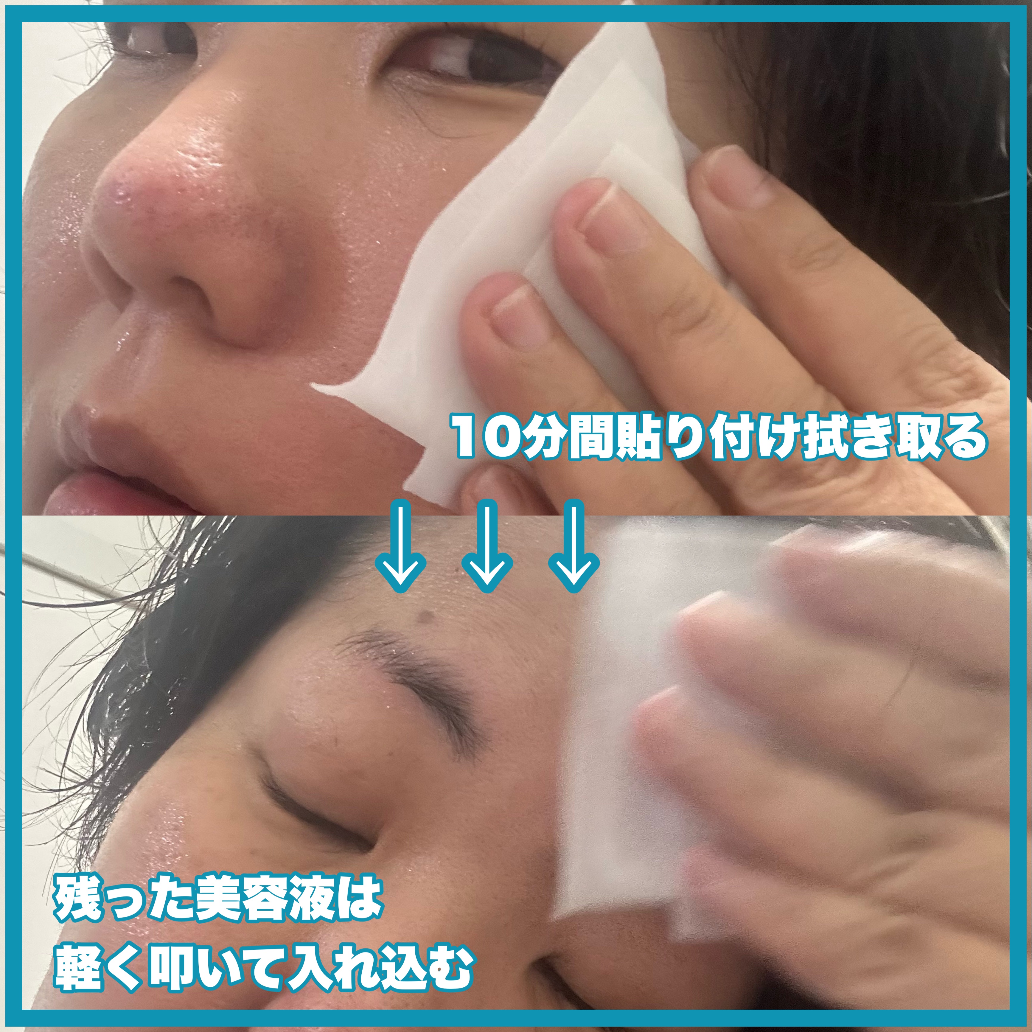 セバムソフトニング131LHAピーリングパッド/Celladix/トナーパッドを使ったクチコミ（3枚目）