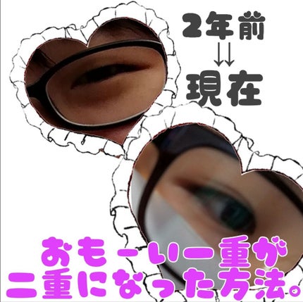 のび〜る アイテープ 両面テープタイプ/DAISO/二重まぶた用アイテムを使ったクチコミ(1枚目)