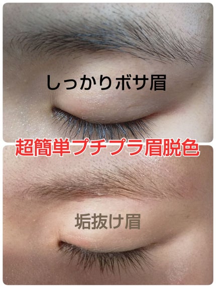 脱色クリーム 敏感肌用/エピラット/ムダ毛ケアを使ったクチコミ(1枚目)