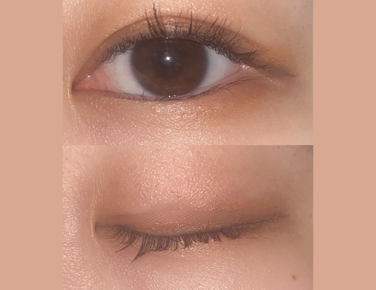 のびーるアイテープ（絆創膏タイプ、レギュラー）/DAISO/二重まぶた用アイテムを使ったクチコミ（1枚目）