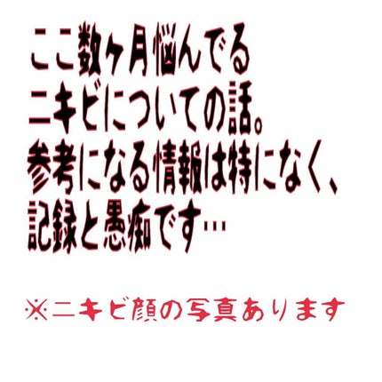 アクアチムローション、アクアチムクリーム(医薬品)/大塚製薬/その他を使ったクチコミ(1枚目)
