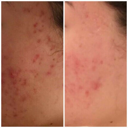 Ayaka on LIPS 「左before右afterサロンの方に同じ距離で撮影していて貰..」(4枚目)