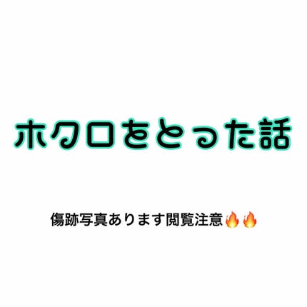 Nexcare/3M nexcare/にきびパッチを使ったクチコミ(1枚目)