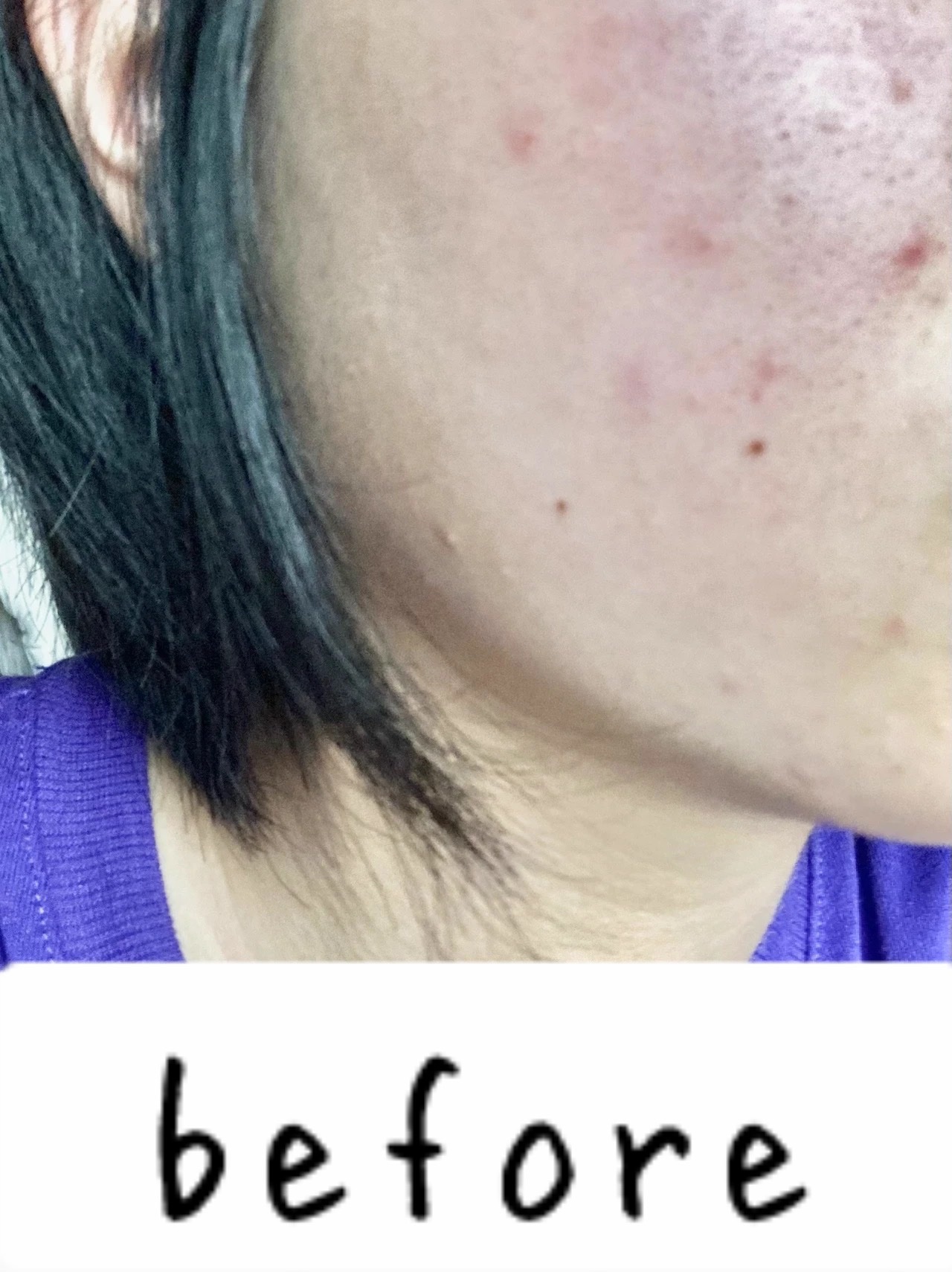 ダーマレーザースーパーVC100マスク/クオリティファースト/シートマスク・パックを使ったクチコミ（2枚目）