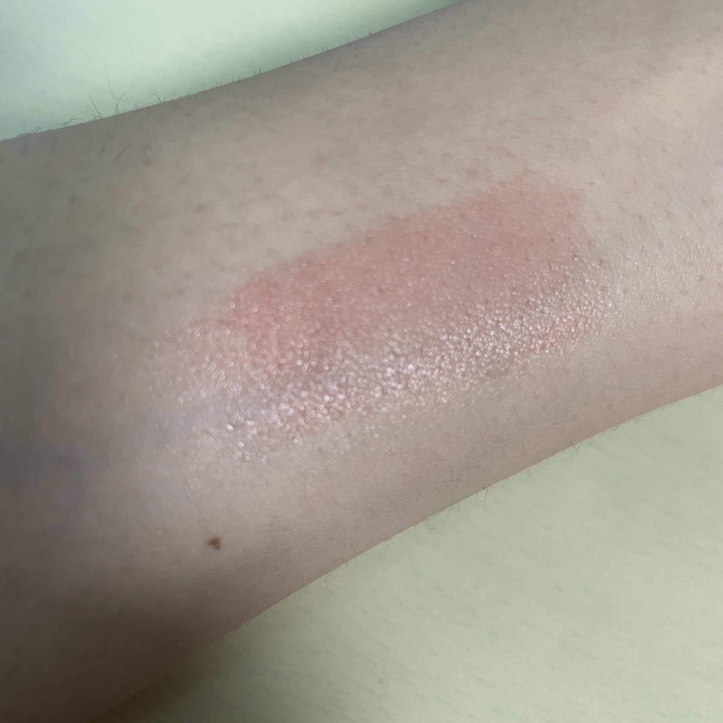 クチュールリップティントグレイズ ブリュレ/espoir/リップティントを使ったクチコミ（3枚目）