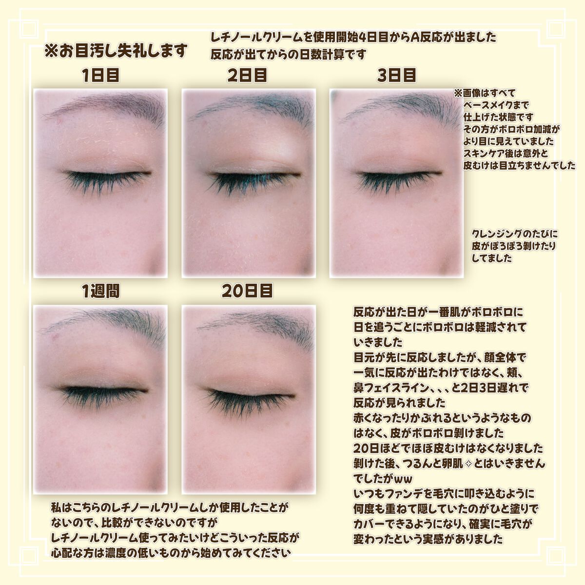 レチノールA 1% アドバンスドリバイタリゼーションクリーム/Life-flo/フェイスクリームを使ったクチコミ(3枚目)