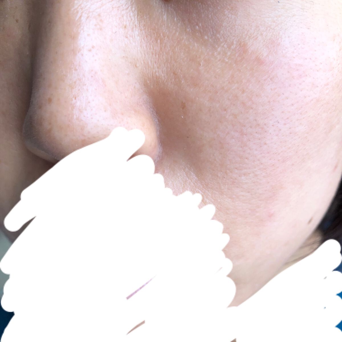 GGエッセンス/KISO/美容液を使ったクチコミ(2枚目)