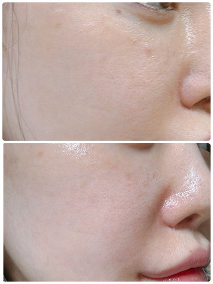 バイオ コンディショニング エッセンス/IOPE/ブースター・導入液を使ったクチコミ(2枚目)