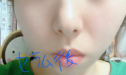 復活草ビフィダセラムファーミングドロップ/Abib /美容液を使ったクチコミ(5枚目)