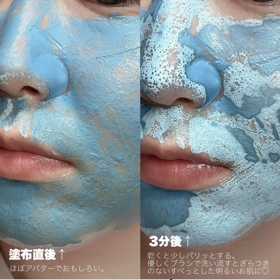 ゼロ毛穴パッド 2.0/MEDICUBE/トナーパッドを使ったクチコミ（3枚目）