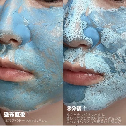 ゼロ1DAYエクソソームショット7500/MEDICUBE/美容液を使ったクチコミ(3枚目)