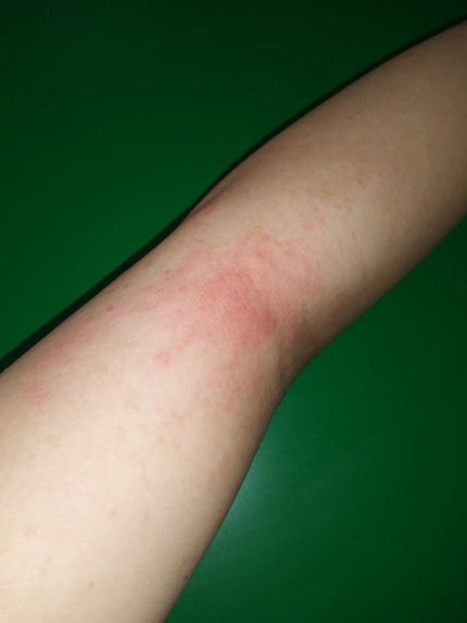 除毛クリームキット(トリートメントEX配合)/エピラット/除毛クリームを使ったクチコミ(2枚目)