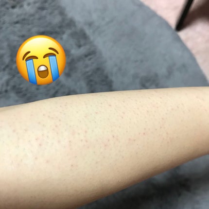 除毛クリーム シトラスホワイトリリィ/スリンキータッチ セルフスパ/除毛クリームを使ったクチコミ(7枚目)