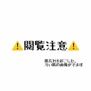 脱毛クリーム MOOMO/自然化粧品研究所/除毛クリームを使ったクチコミ（2枚目）