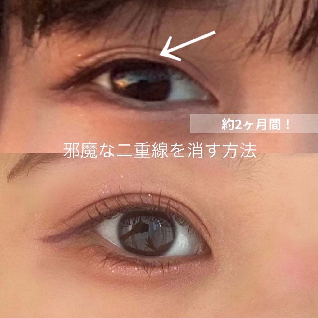 LJ 水で貼るふたえテープ 02 ナチュラルスリム/ドゥ ベスト/二重まぶた用アイテムを使ったクチコミ(1枚目)