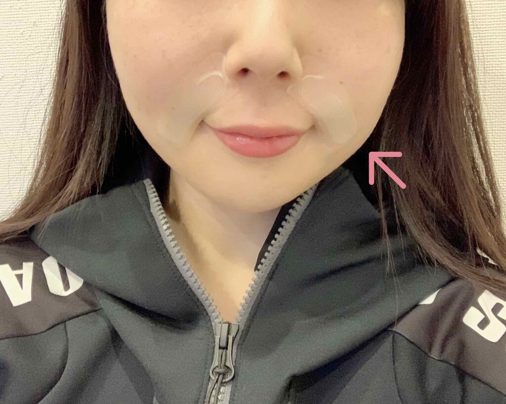 メディリフト 3Dマイクロフィラー(口元用)/YA-MAN TOKYO JAPAN/シートマスク・パックを使ったクチコミ(3枚目)