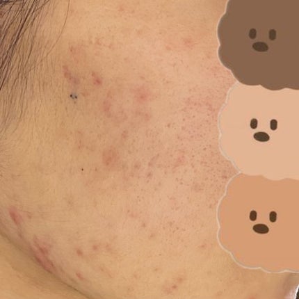 colza on LIPS 「-肌日記230227-2月中旬ぐらいから食欲が一気になくなって..」(5枚目)