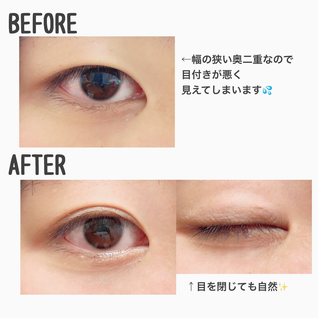 ãªãªã·ã ã¢ã€ãªããã¹ãã³ãã£ã«ã /D-UP/äºéãŸã¶ãçšã¢ã€ãã ã䜿ã£ãã¯ãã³ãïŒ3æç®ïŒ