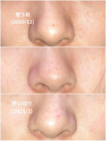 ロゼット洗顔パスタ 海泥スムース/ロゼット/洗顔フォームを使ったクチコミ(4枚目)