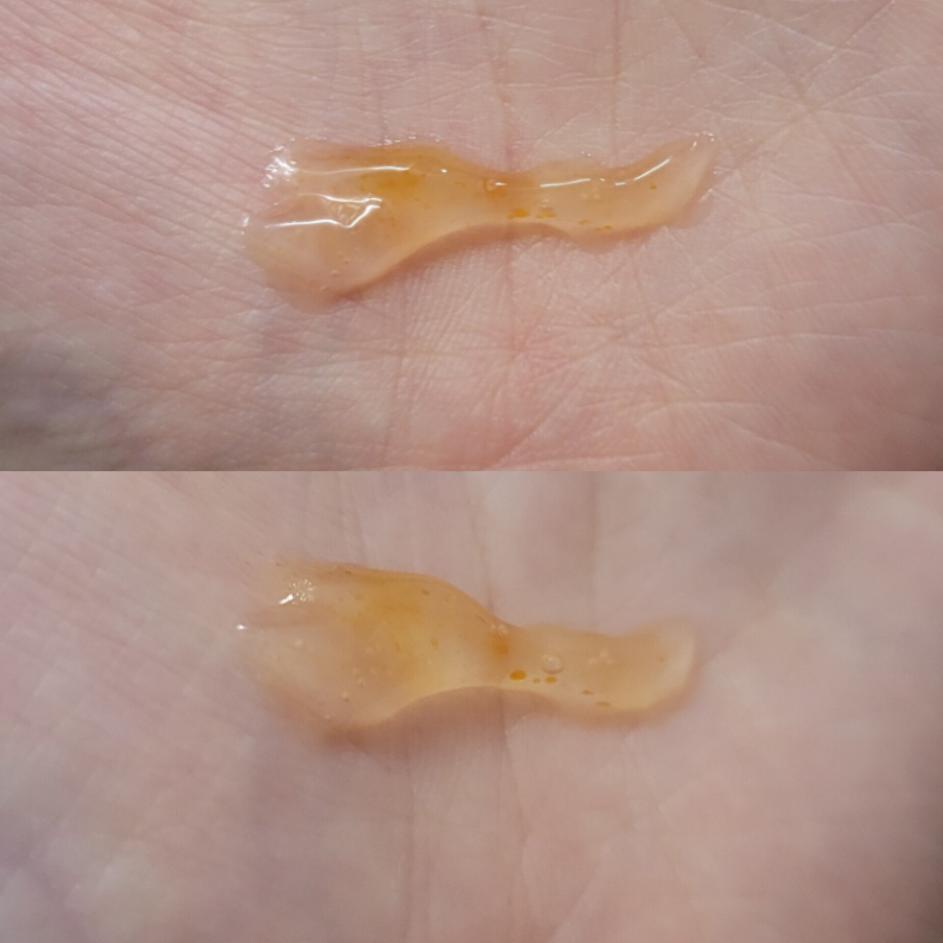 アスタリライズV3エッセンス/アトレージュ AD＋/美容液を使ったクチコミ（3枚目）