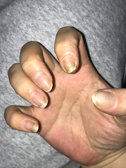 ジェルネイル(ライト対応)/セリア/ジェルネイルを使ったクチコミ(5枚目)