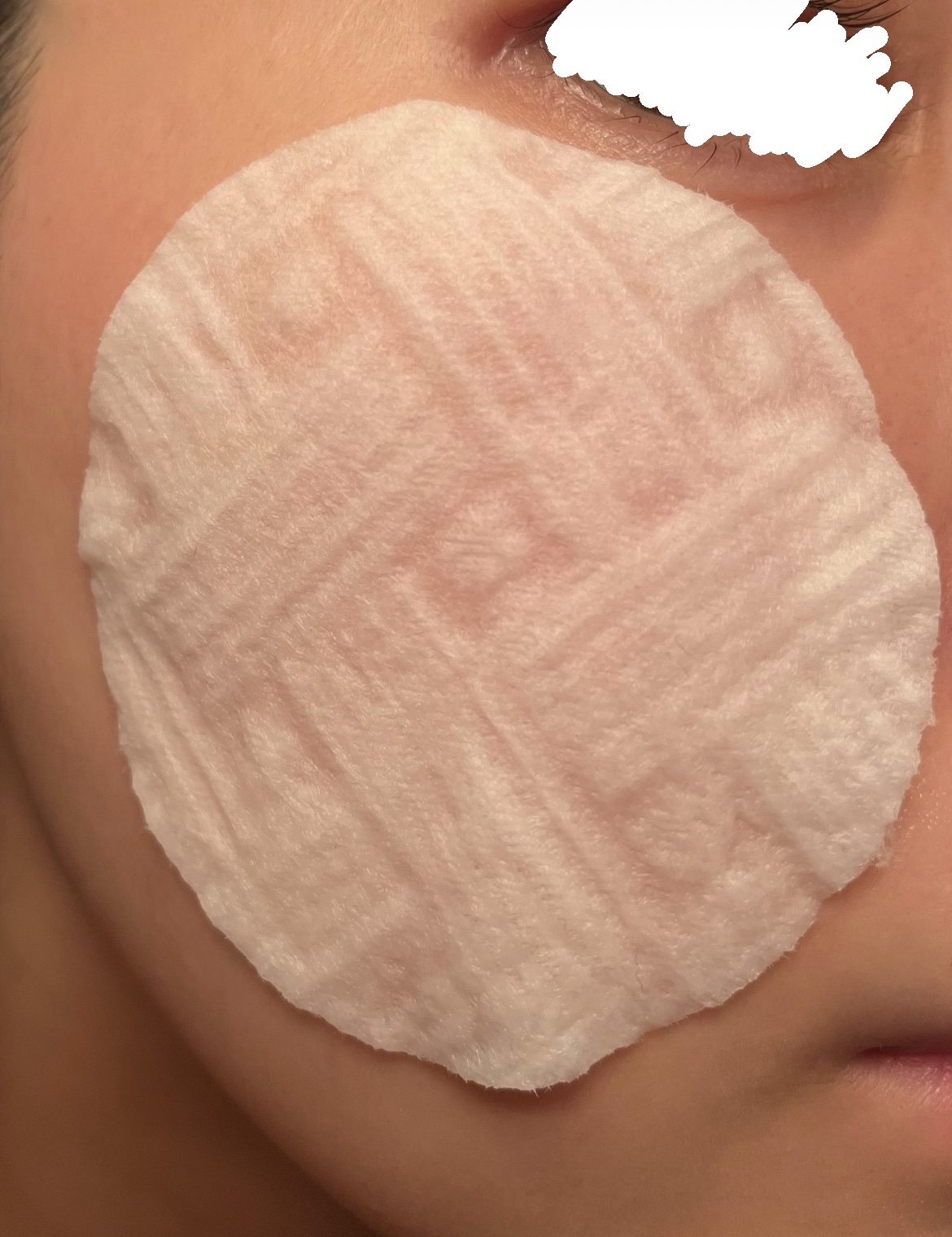 マデカ メラキャプチャーアンプルパッド/センテリアン24/トナーパッドを使ったクチコミ（3枚目）