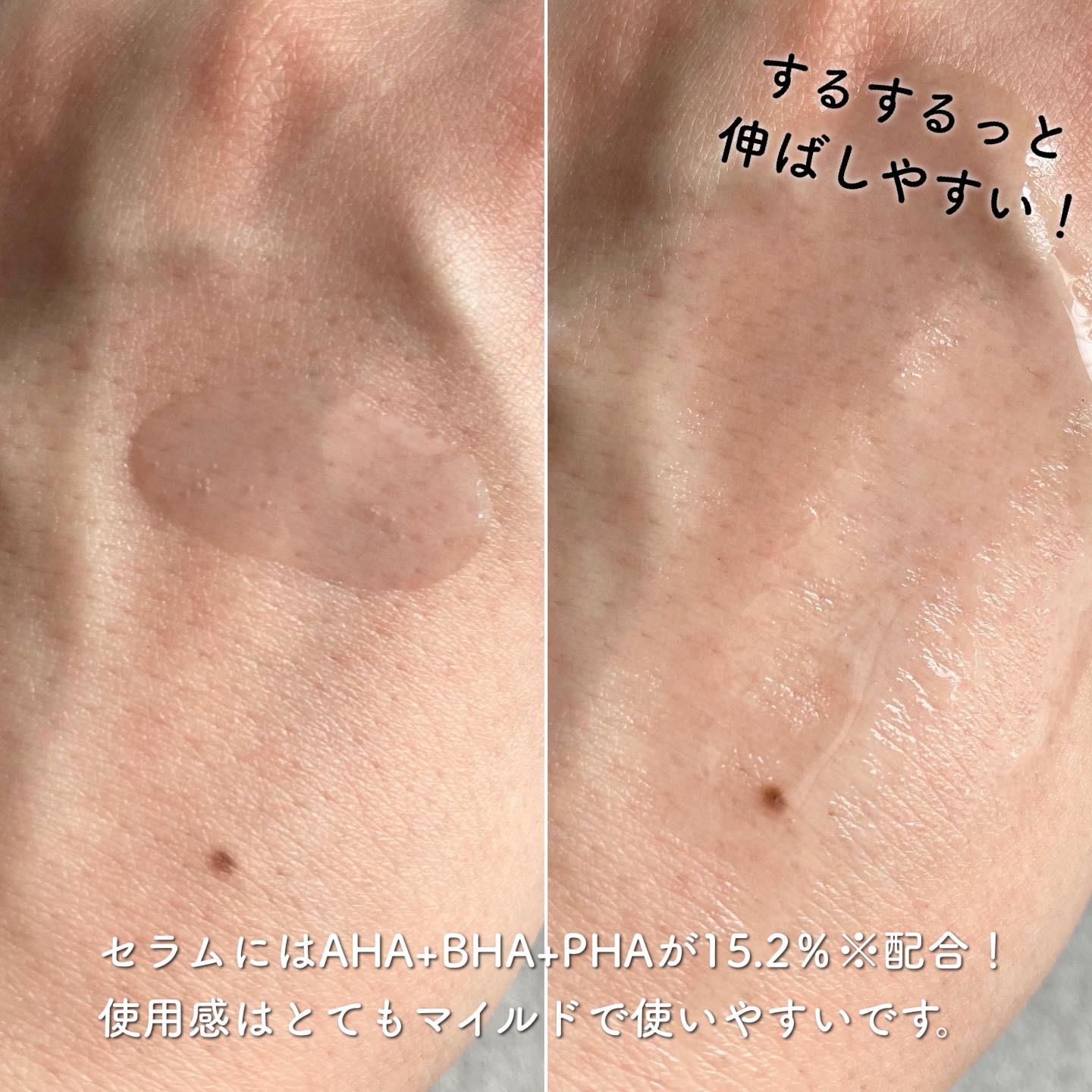 ゼロ毛穴パッド 2.0/MEDICUBE/トナーパッドを使ったクチコミ（3枚目）