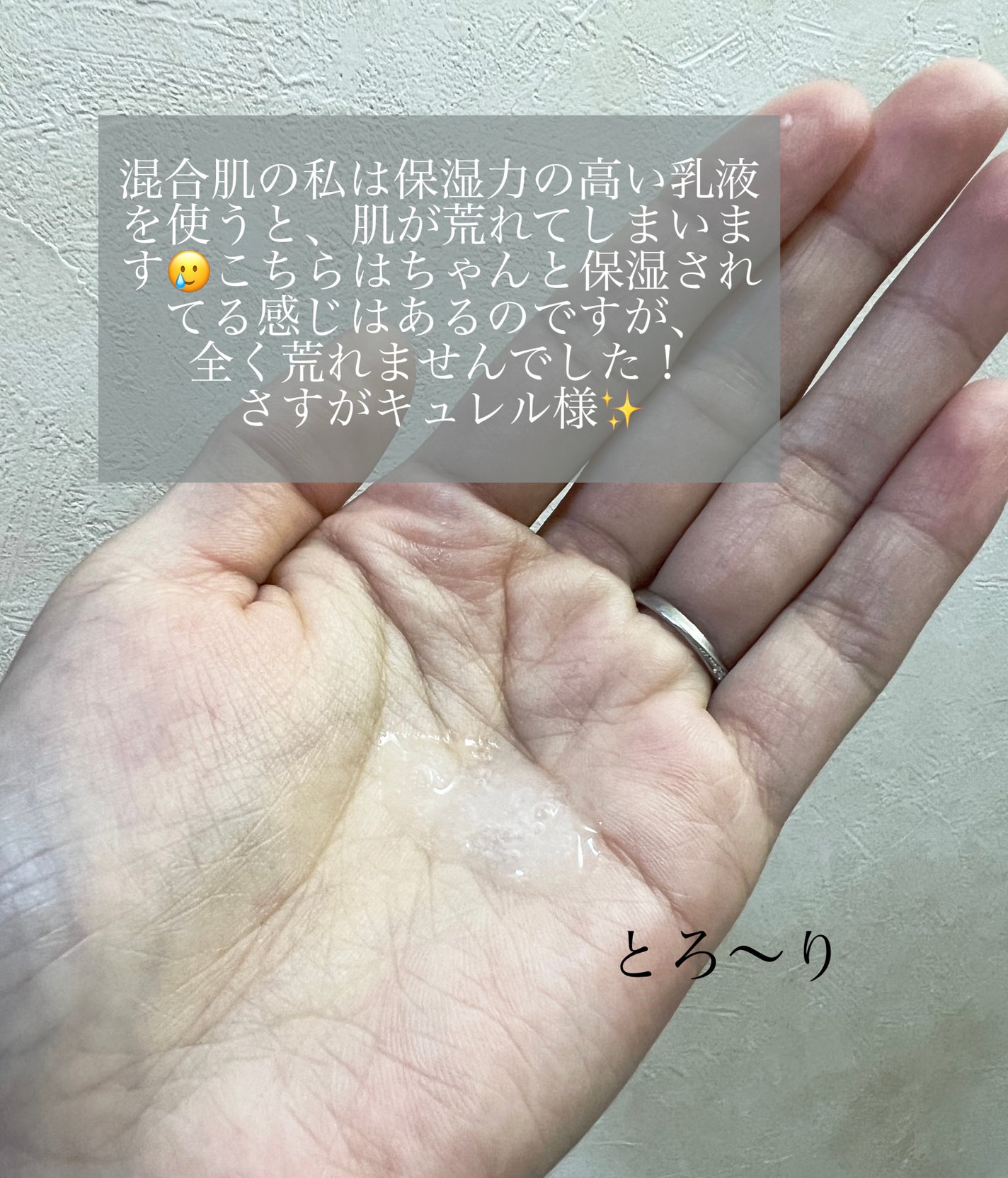 皮脂トラブルケア 保湿ジェル/キュレル/化粧水を使ったクチコミ(2枚目)