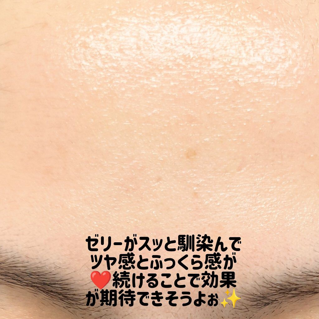 フィルアップボリュームスポット/Easydew/美容液を使ったクチコミ（3枚目）