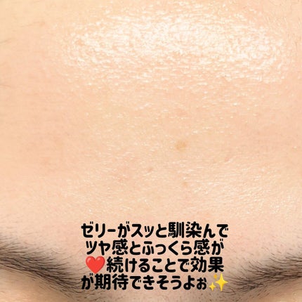 フィルアップボリュームスポット/Easydew/美容液を使ったクチコミ(3枚目)