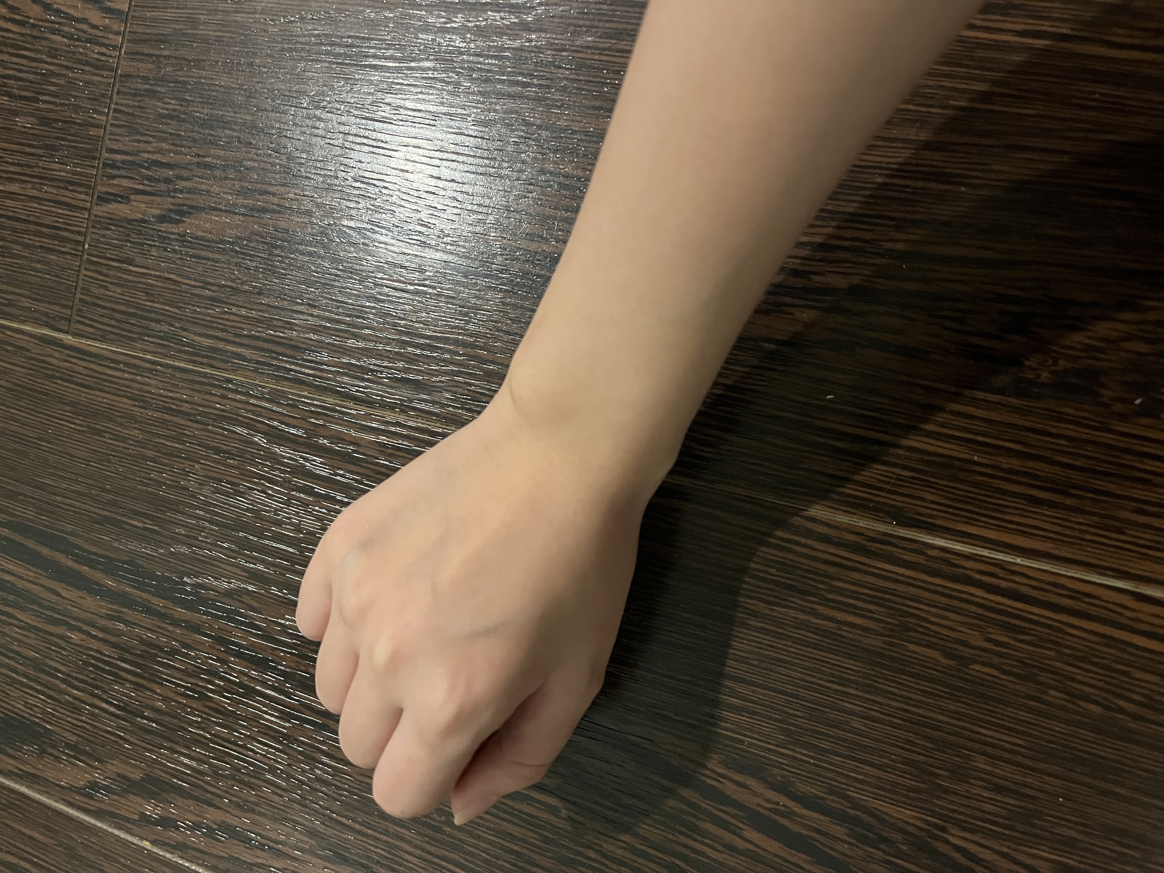 ホワイトルマン(医薬品)/ミスミ製薬/その他を使ったクチコミ（2枚目）