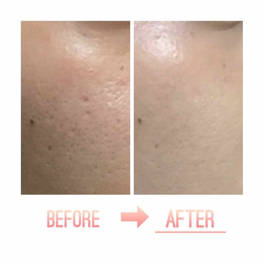 マイクロセッティングフィットEX SPF50+PA++++ Micro setting fit Cushion EX/moonshot/クッションファンデーションを使ったクチコミ(2枚目)