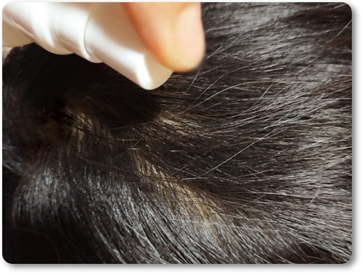 アントレッドヘアローション/ENTRAIDE/頭皮ローションを使ったクチコミ(4枚目)