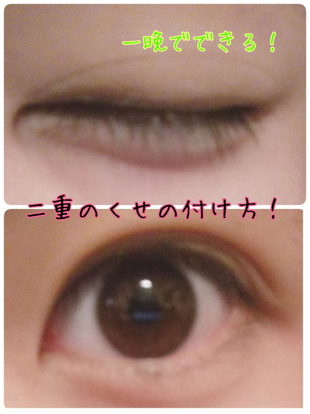 アイプチ リキッドテープN/アイプチ®/二重まぶた用アイテムを使ったクチコミ（1枚目）