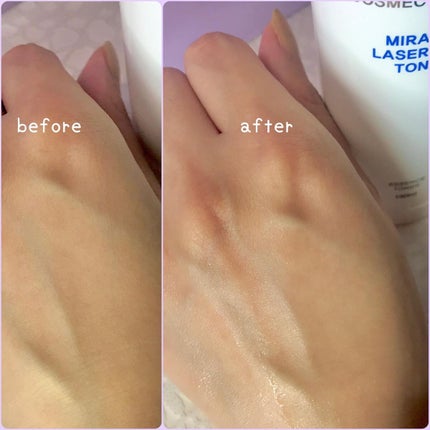 ミラクルレーザースキントナー/トアス/化粧水を使ったクチコミ(4枚目)