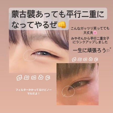 ãã¯ãð° on LIPS ããããªéãçŒã¯äºéã«ãªããªããèå€è¥ããããšäºéã«ãªããªããæ..ãïŒ1æç®ïŒ