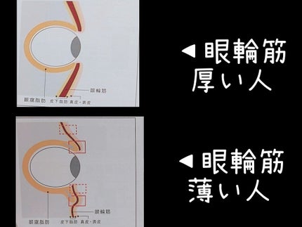 アイゾーンクリーム/B.A/アイケア・アイクリームを使ったクチコミ(6枚目)