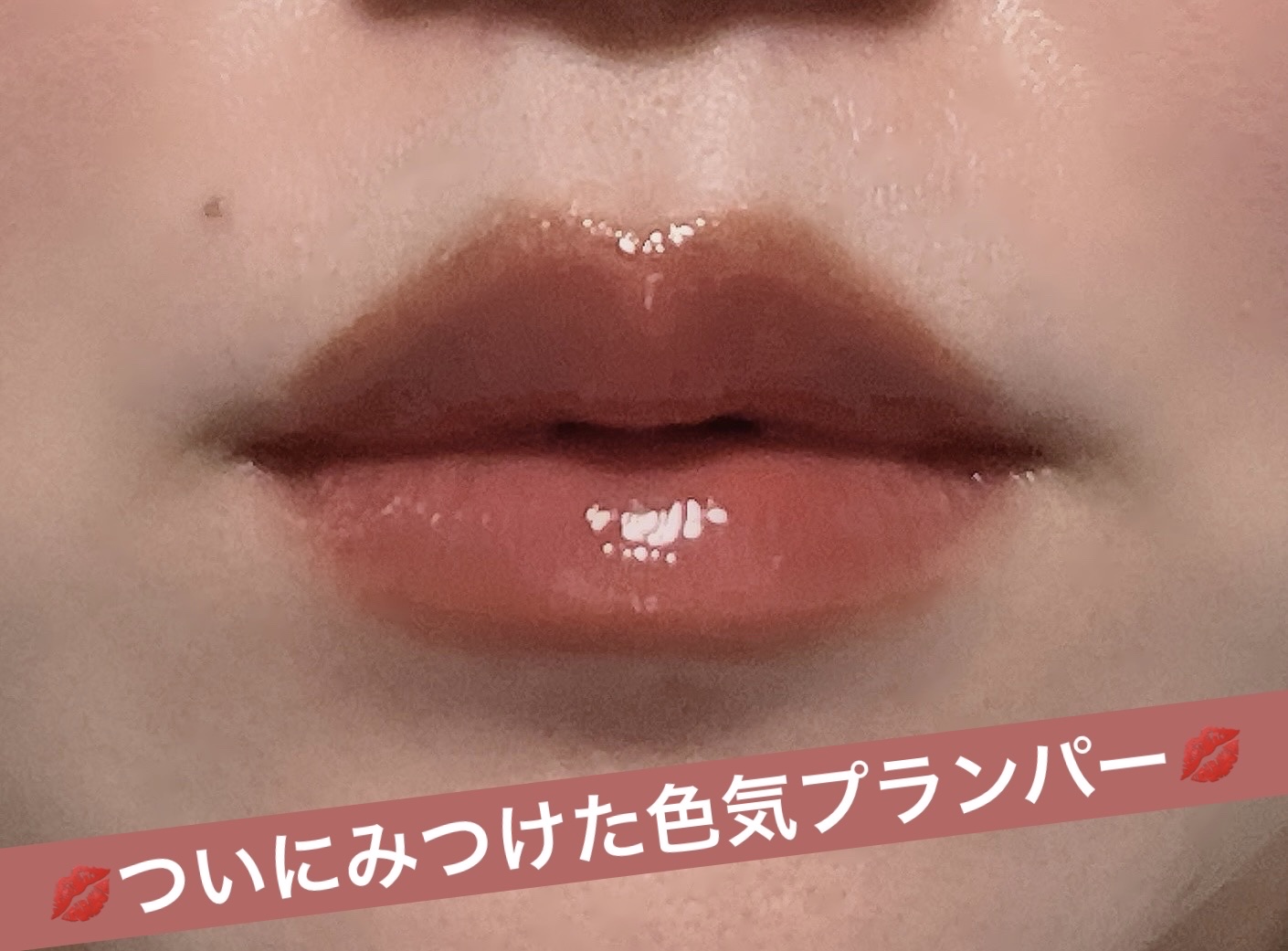 ニードルプランパー 高熱フィグ/Ui2./リッププランパーを使ったクチコミ（1枚目）