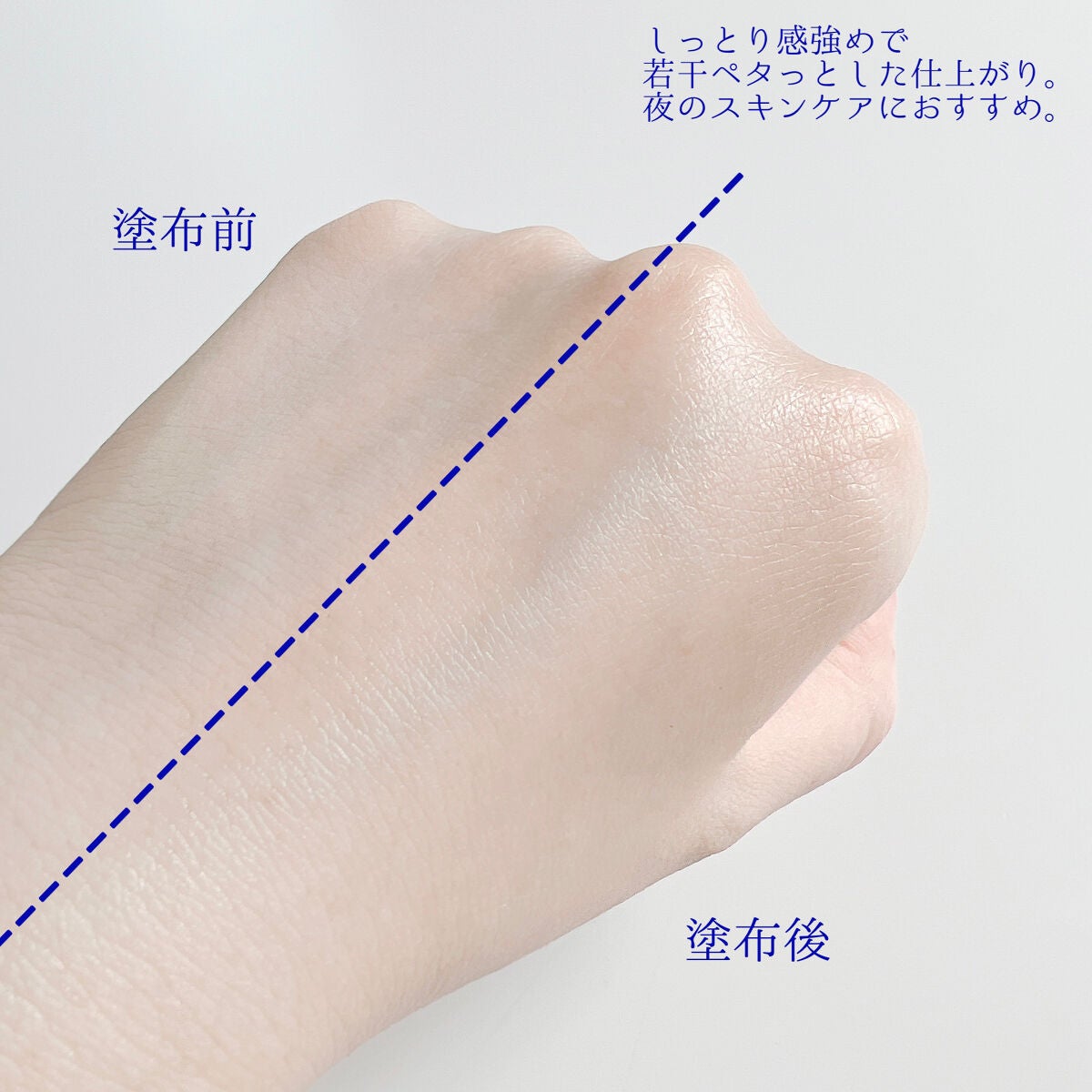 ゼロ毛穴1DAYセラム/MEDICUBE/美容液を使ったクチコミ(5枚目)