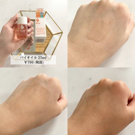 バイオイル/バイオイル/フェイスオイルを使ったクチコミ(2枚目)