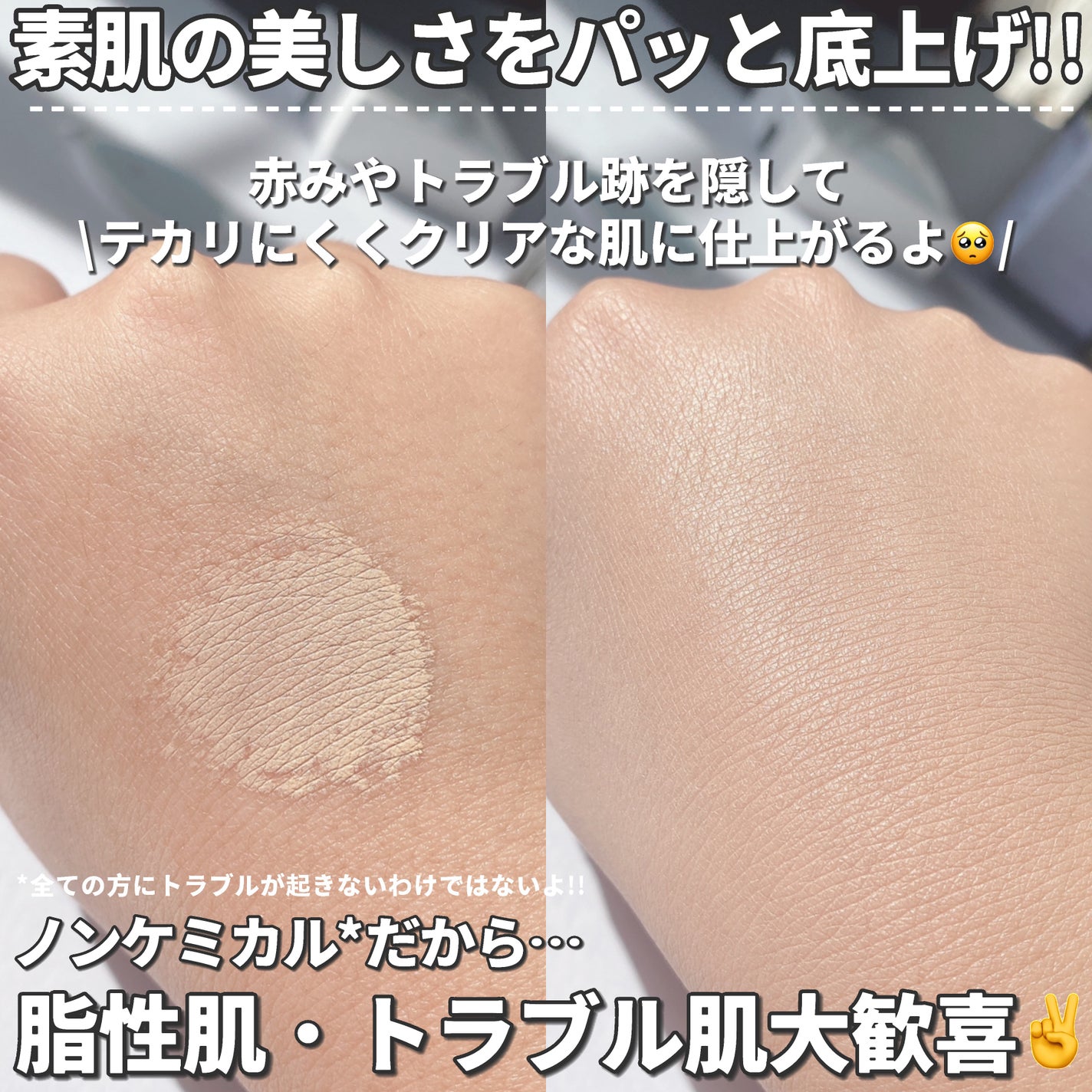 レイヤリングフィットカバークッションEX/TFIT/クッションファンデーションを使ったクチコミ(2枚目)