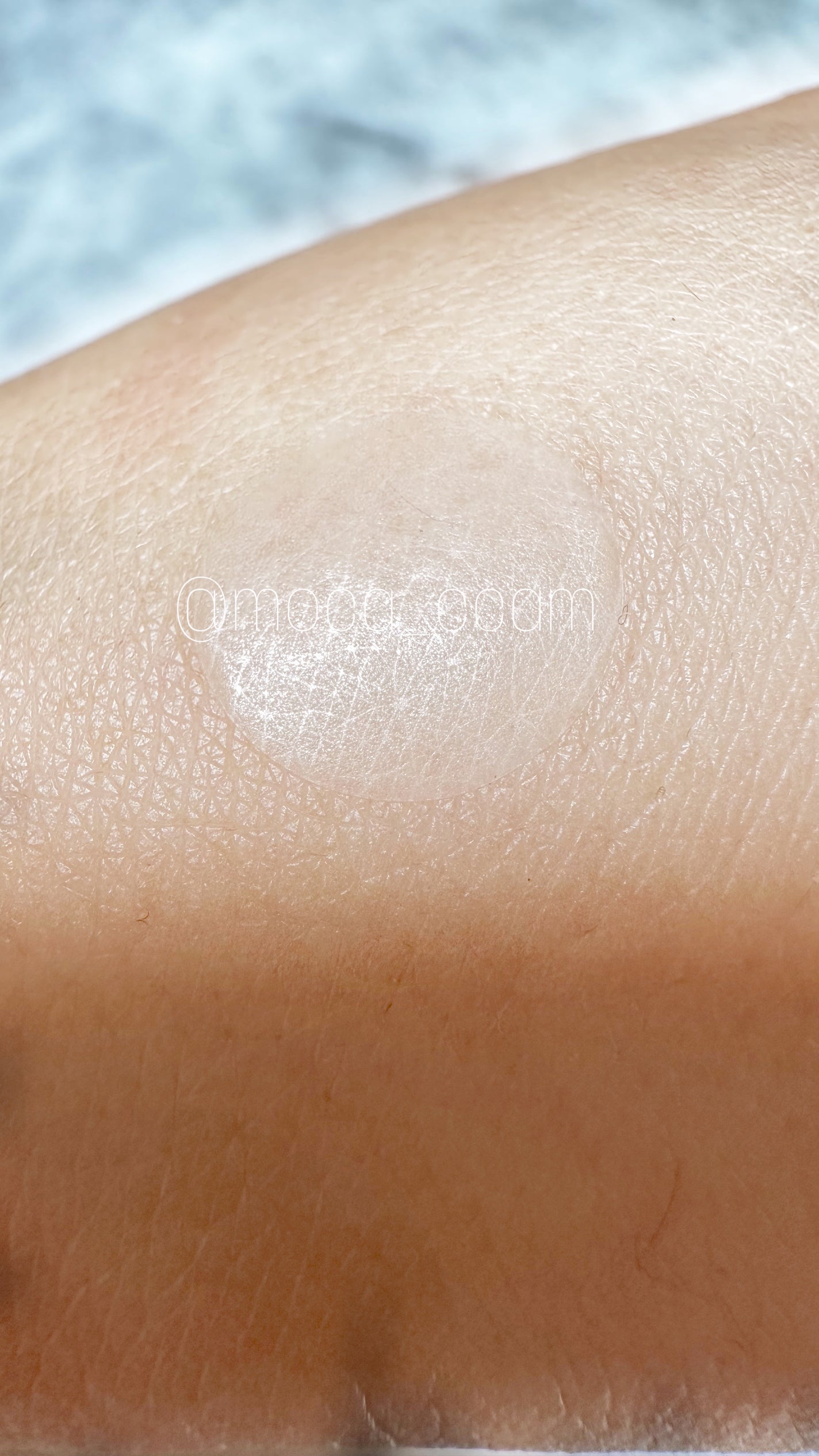 極薄透明パッチ nikipa!/金冠堂/にきびパッチを使ったクチコミ(5枚目)