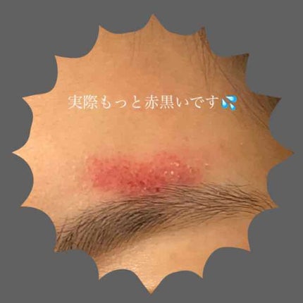 長柄カミソリ ビューティーM /貝印/シェーバーを使ったクチコミ(2枚目)