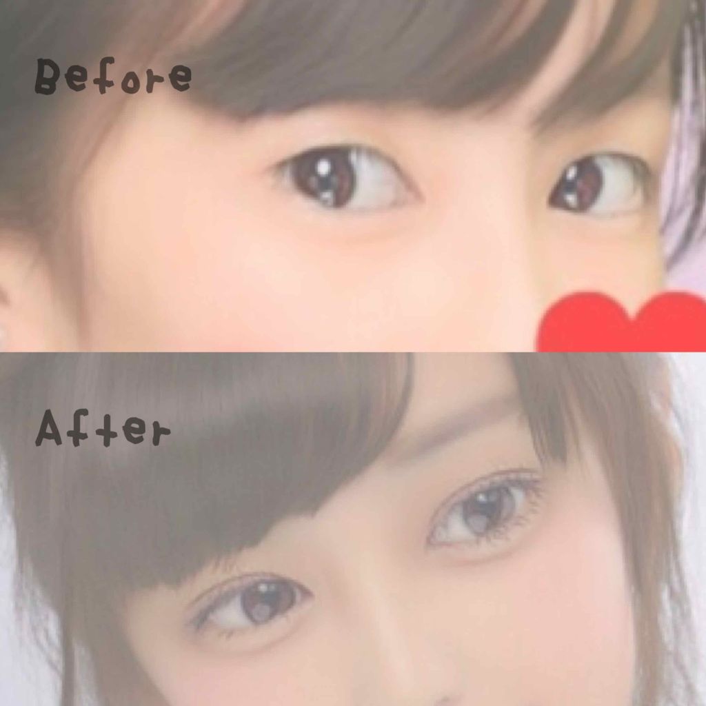 のびーるアイテープ（絆創膏タイプ、レギュラー）/DAISO/二重まぶた用アイテムを使ったクチコミ（2枚目）